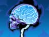 Neurosurge